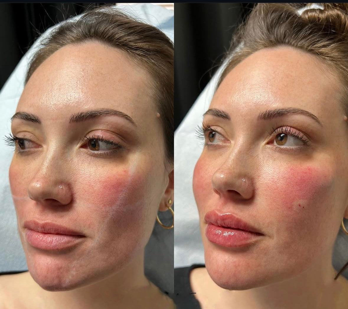 Full Facial Balancing