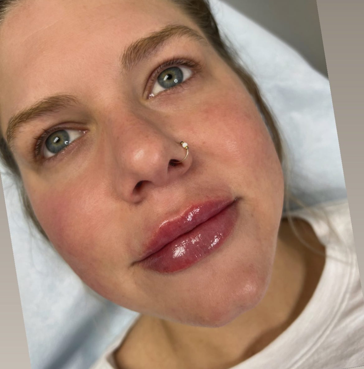 Volume Lips