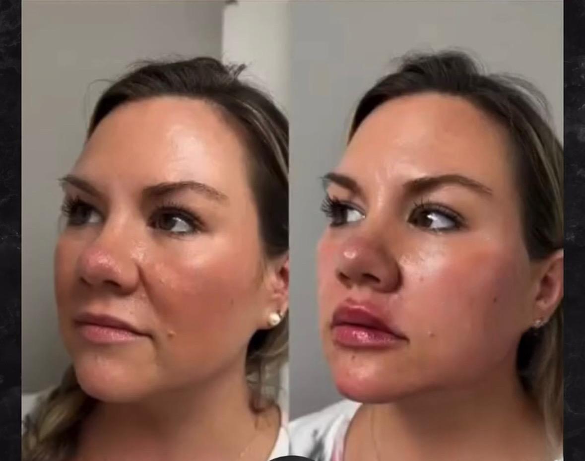 Full Facial Balancing