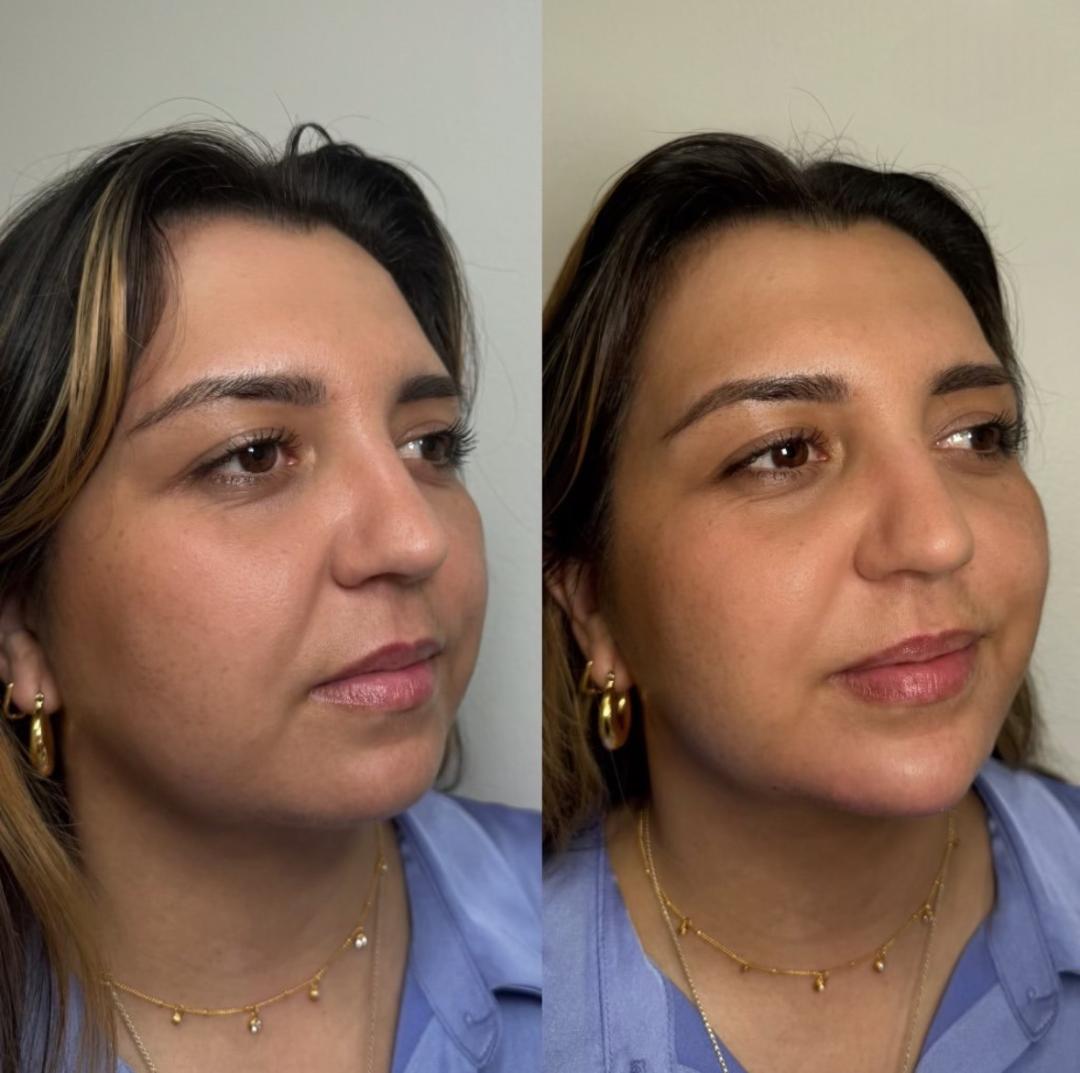Mini Facial Balancing