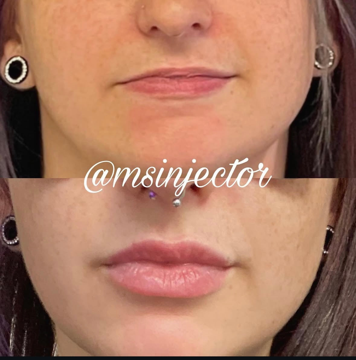 Mini Lip Plump