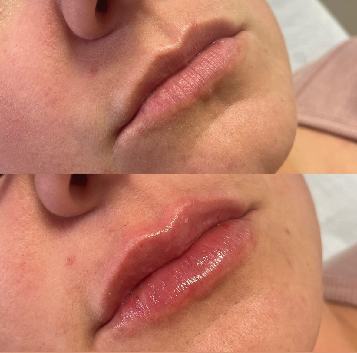 Mini Lip Plump