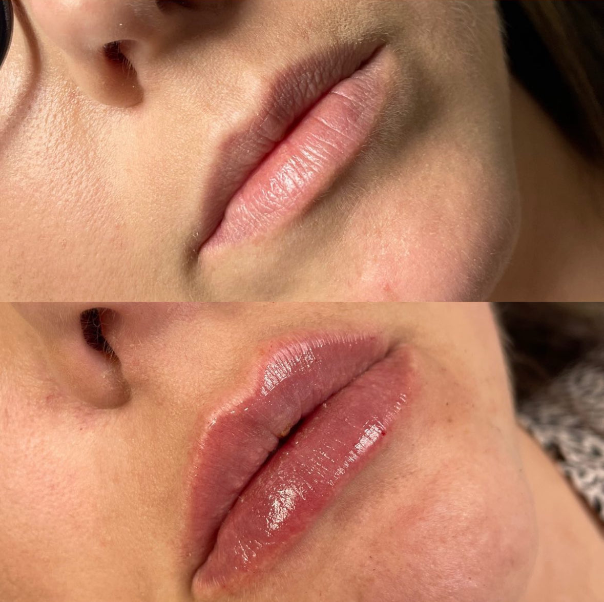 Mini Lip Plump