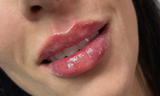 Volume Lips