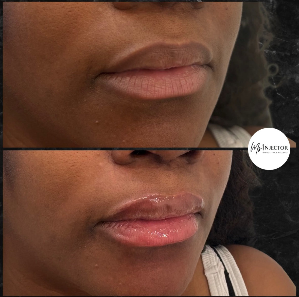 Mini Lip Plump